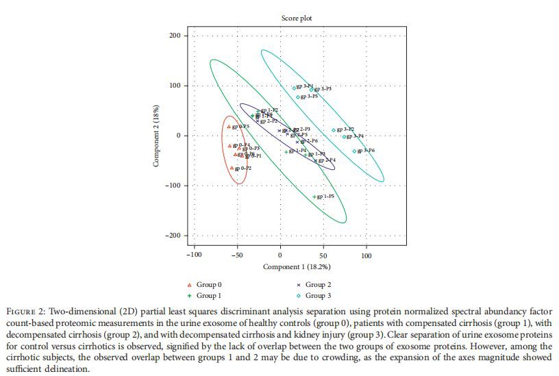 Two-dimensional (2D) partial least squares discriminant analysis separation using protein normalized spectral abundancy factor count-based proteomic measurements in the urine exosome of healthy controls (group 0), patients with compensated cirrhosis (group 1), with decompensated cirrhosis (group 2), and with decompensated cirrhosis and kidney injury (group 3). Clear separation of urine exosome proteins for control versus cirrhotics is observed, signified by the lack of overlap between the two groups of exosome proteins. However, among the cirrhotic subjects, the observed overlap between groups 1 and 2 may be due to crowding, as the expansion of the axes magnitude showed sufficient delineation.