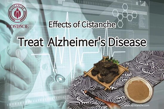Anti Alzheimer's disease (13) Anti Alzheimer's disease (13)